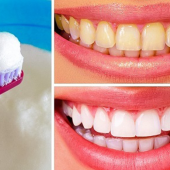 Thử ngay 10 cách làm trắng răng siêu đơn giản