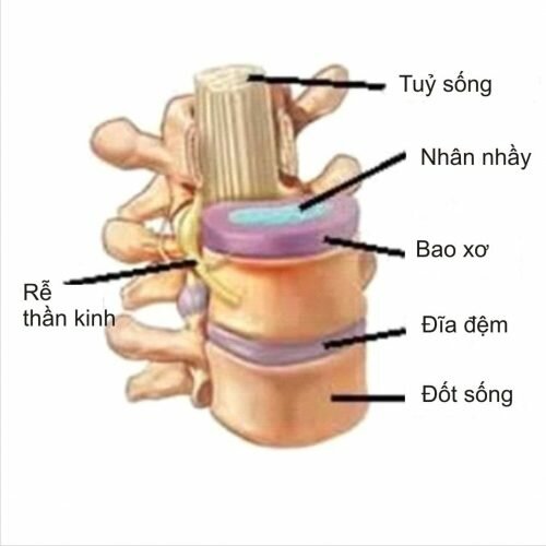 Thoát vị đĩa đệm cột sống cổ là gì, các dấu hiệu thường gặp 1