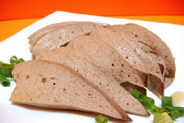 người già bị teo não 3