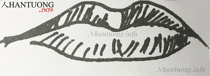 Hình dáng tướng miệng cá chép Hình dáng tướng miệng cá chép