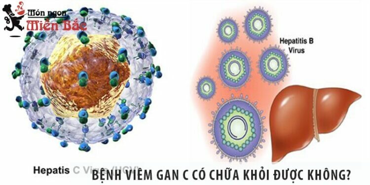 Bệnh viêm gan C có chữa khỏi được không?
