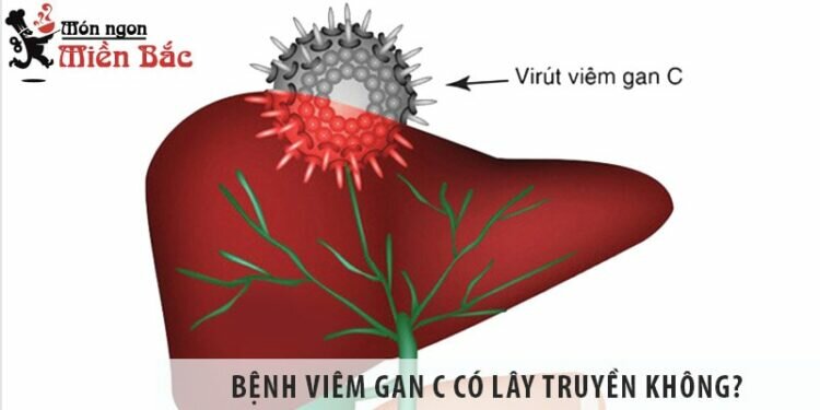 Bệnh viêm gan C có lây không? Cách phòng tránh lây nhiễm