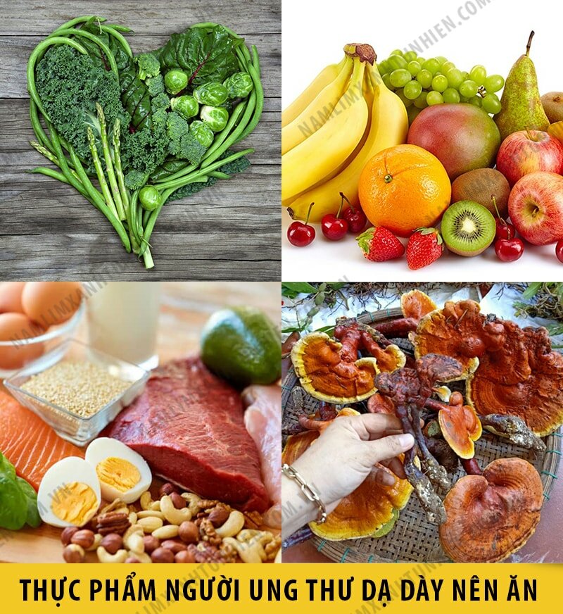 Những thức ăn mà người bị ung thư dạ dày nên ăn Những thức ăn mà người bị ung thư dạ dày nên ăn