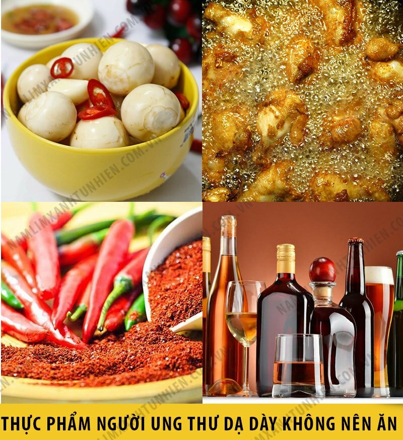 Những thức ăn mà người bị ung thư dạ dày nên kiêng Những thức ăn mà người bị ung thư dạ dày nên kiêng