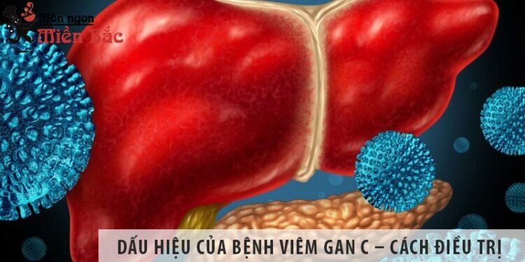 Dấu hiệu của bệnh viêm gan C – cách phòng tránh và điều trị