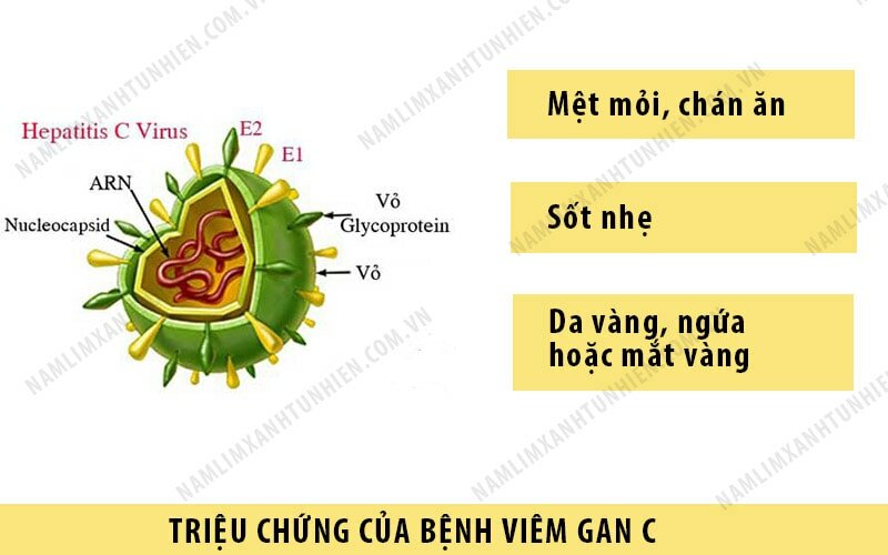 Triệu chứng bệnh viêm gan C cấp tính Triệu chứng bệnh viêm gan C cấp tính