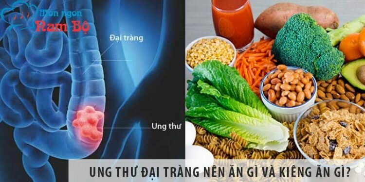 Người bị ung thư đại tràng nên ăn gì, nên kiêng ăn gì? Người bị ung thư đại tràng nên ăn gì, nên kiêng ăn gì?