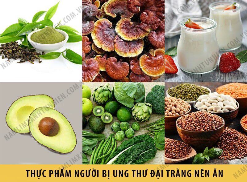 Những thức ăn mà người bị ung thư đại tràng nên ăn