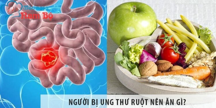 Người bị ung thư ruột nên ăn gì và không nên ăn gì? Người bị ung thư ruột nên ăn gì và không nên ăn gì?